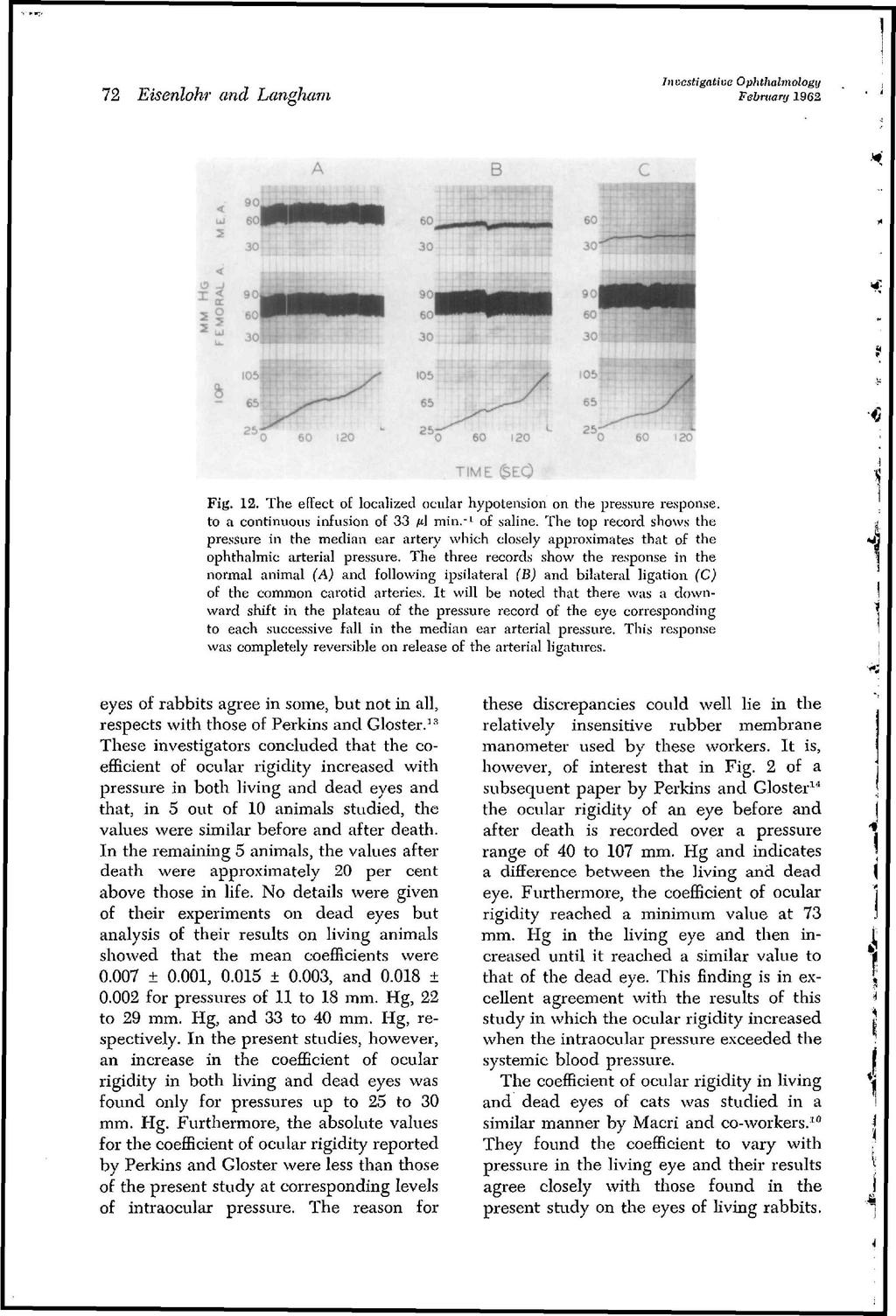 72 Eisenlohr and Langham.stigatiue Ophtliahnology February 1962 TIME E0 Fig. 12. The effect of localized ocular hypotension on the pressure response, to a continuous infusion of 33 /id min.