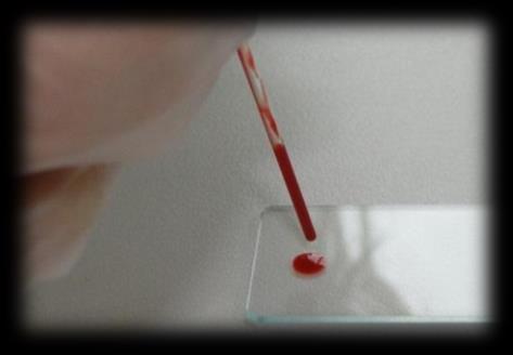 Once blood has spread along the edge of the second slide then push it away