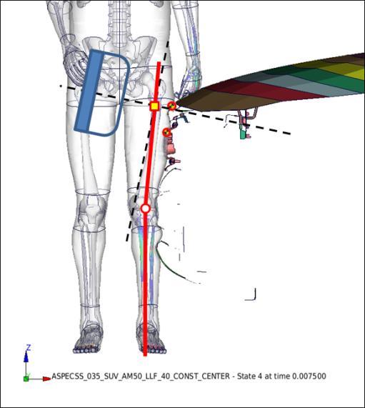 T = 0 (Initial condition) T = T0 (Initial contact) T = T* (Maximum load) Figure 5-21: Proposed conditions for upper leg impactor setup in