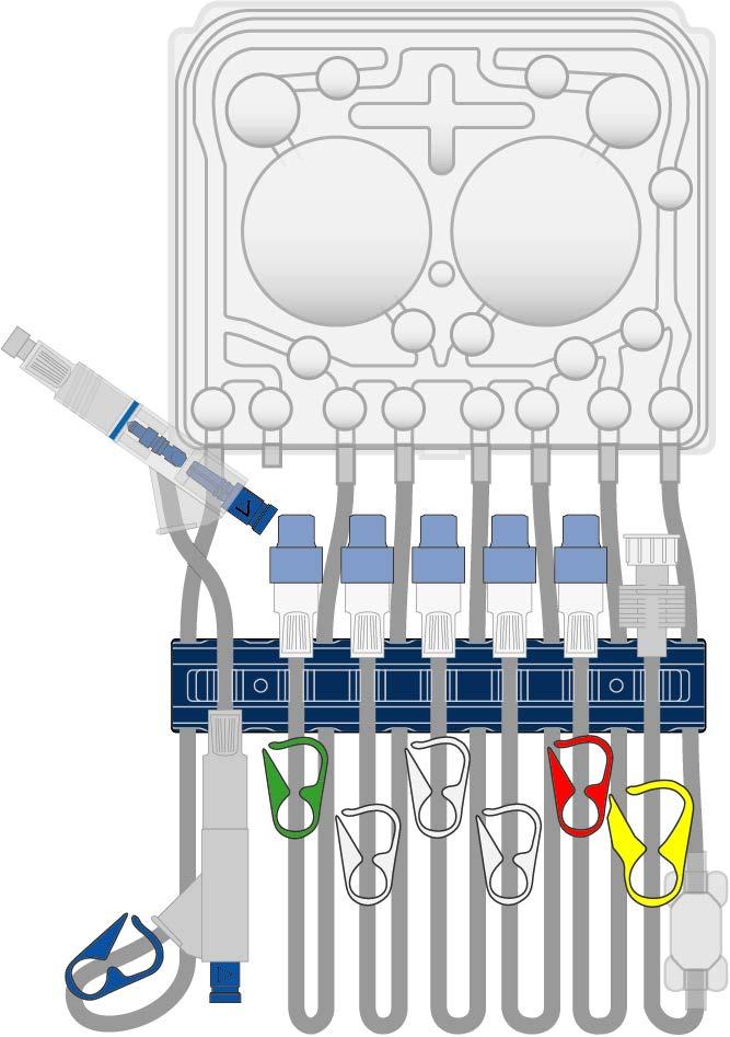 The Cassette and Tubing Set stay safe PIN connector 1 stay safe PIN connector 2 stay safe PIN Connector Patient Line (Blue Clamp) Last Bag