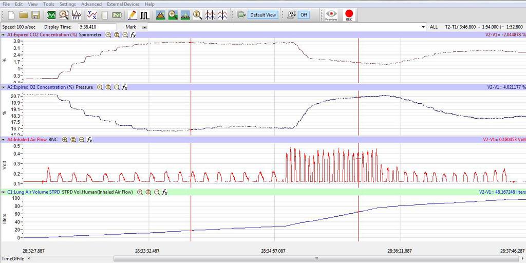 Figure HE-4-L4: Recording of gas concentrations and lung volumes from a hyperventilating subject.