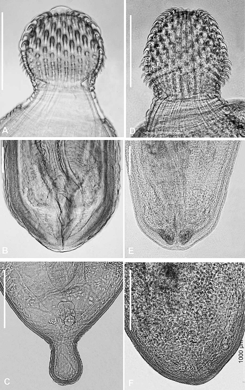 1180 THE JOURNAL OF PARASITOLOGY, VOL. 98, NO. 6, DECEMBER 2012 FIGURE 4. (A C) Porrorchis kinsellai n. sp. (A) Proboscis. (B) Male, posterior end.