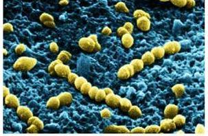 102 Genus: Streptococcus 413. Kingdom: Bacteria Phylum: Firmicutes Class: Bacilli Order: Lactobacillales Streptococcus bovis Pinpoint, semi-transparent, smooth kolonier.