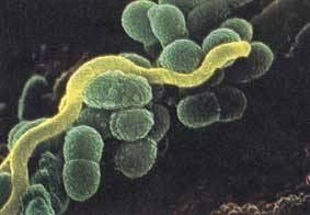 mutans. It is nonmotile, Gram-positive, nonsporeforming bacteria, that live in pairs or chains of varying length. They are characteristically round or ovoid in shape.