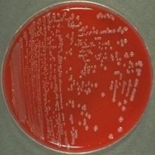 103 Genus: Shigella 417. Kingdom: Bacteria Class: Gammaproteobacteria Order: Enterobacteriales Shigella boydii Shigella boydii is a Gram-negative bacteria of the genus Shigella.