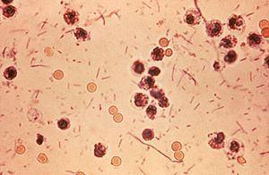Kingdom: Bacteria Phylum: Actinobacteria Class: Actinobacteria Order: Actinomycetales Family: Streptomycetaceae Genus: Streptomyces 420.