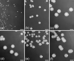 10 16. Acinetobacter parvus genus of Gram-negativebacteria belonging to the Gammaproteobacteria.