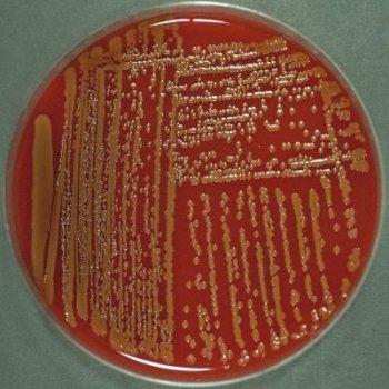 109 441. Kingdom: Bacteria Class: Gammaproteobacteria Order: Enterobacteriales Family: Enterobacteriaceae Genus: Serratia 442.