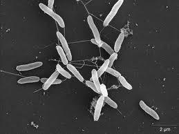 Kingdom: Bacteria Phylum: Proteobactria Class: Gammaprotebacteria Order: Alteromonadales Family: Shewanellaceae Genus: Shewanella 448.