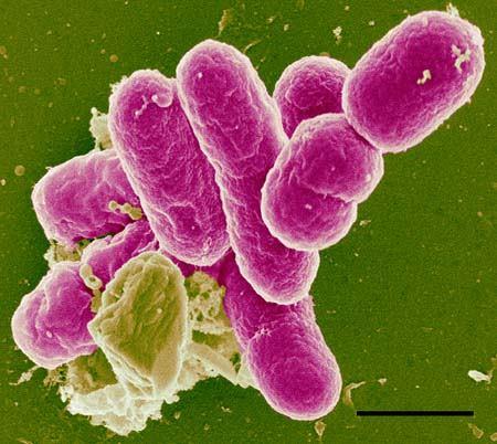 Kingdom: Bacteria Class: Gammaproteobacteria Order: Enterobacteriales Family: Enterobacteriaceae Genus: Shigella 465.