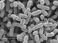 115 Class: Gammaproteobacteria Order: Enterobacteriales Family: Enterobacteriaceae Genus: Shigella shape bacterium and is lactose-fermenting bacterium causing dysentery.