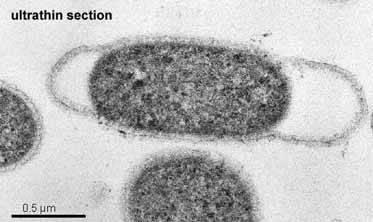 123 500. Kingdom: Bacteria Phylum: Thermotogae Class: Thermotogae Order: Thermotogales Family: Thermotogaceae Genus: Thermotoga 501.