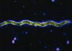 This aerobic gram-negative organism is typically nonsporeforming and metabolizes several carbohydrates, both simple and complex, including glucose, sucrose, starch, cellulose, and xylan (EBI, 2003).