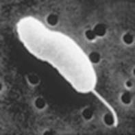 126 Family: Vibrionaceae Genus: Vibrio potentially fatal illness. Infections tend to occur through eating raw or improperly cooked shellfish, particularly oysters. 513.