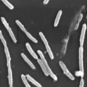Kingdom: Bacteria Class: Gammaproteobacteria Order: Enterobacteriales Family: Enterobacteriaceae Genus: Pantoea Vibrio splendidus Variovorax paradoxus It is a gram negative bacterium.