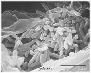 134 542. Kingdom: Bacteria Class: Gammaproteobacteria Order: Xanthomonadales Xylella fastidiosa Xylella fastidiosa.
