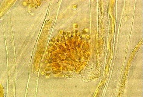 139 16. Kingdom: Fungi Phylum: Ascomycota Class: Eurotiomycetes Order: Eurotiales Family: Trichocomace Genus: Aspergillus 17.