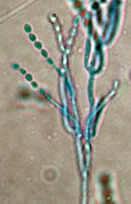 Phialides are swollen at their bases, gradually tapering into a slender neck. Conidia are ellipsoidal to fusiform, smooth-walled to slightly roughened, hyaline to purple in mass, 2.5-3.0 x 2-2.