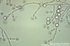 166 154. Kingdom: Fungi Division: Ascomycota Candida sp. Degradation of Phenolic wastes.