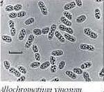 17 Class: Betaproteobacteria Order: Burkholderiales Family: Alcaligenaceae Genus: Alcaligenes 48. 49.