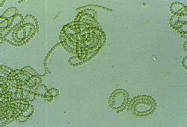 18 52. Domain- Bacteria Phylum- Cyanobacteria Class-Cyanobacteria Order- Nostacales Family - Nostocaceae Genus- Anabena Anabena variabilis It is a species of filamentous cyanobacterium.