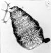 190 Phylum: Radiozoa Order: Nassellaria Family: Theoperidae Genus: Botrystrobus 16.