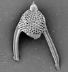 Kingdom: Chromista Phylum: Radiozoa Order: Spumellaria Lychnocanoma elongata (Vinassa de
