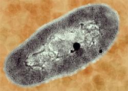 Domain: Bacteria Phylum: Actinobacteria Classis: Actinobacteria Subclassis: Actinobacterida e Ordo: Actinomycetales Subordo: Micrococcineae Familia: Micrococcaceae Genus: Arthrobacter 71.