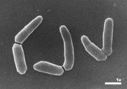 Domain: Bacteria Phylum: Actinobacteria Classis: Actinobacteria Subclassis: Actinobacterida e Ordo: Actinomycetales Subordo: Micrococcineae Familia: Micrococcaceae Genus: Arthrobacter Arthrobacter