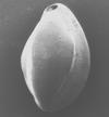 Kingdom: Protozoa Class: Granuloreticulosea Order: Foraminiferida Family: Lituolidae Genus: Psammosphaera Psammosphaera sp. (Schulze) Voring Basin, offshore Norway. SEM.