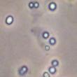Kingdom: Bacteria Phylum: Actinobacteria Amycolatopsis orientalis Production of ristocetin A & B Class: Actinobacteria Order: