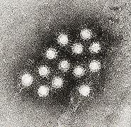 233 Species: Hepatitis A virus 9 Group: Group IV(ssRNA- RT) Family: Retroviridae Genus: Lentivirus Species: HIV Virus 10 Group: Group I (dsdna) Order: Unranked Family: Papillomaviridae Genus: Human