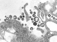234 Genus: Arenavirus Species: Lassa virus Nigeria and Liberia, where the annual incidence of infection is between 300,000 and 500,000 cases, resulting in 5,000 deaths per year.