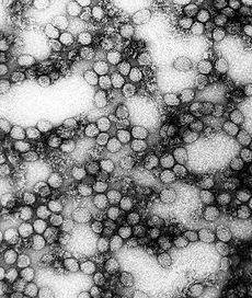 Filoviridae Genus: Ebolavirus Species: Zaire ebolavirus West Nile Virus Yellow fever virus Zaire ebolavirus WNV is one of the Japanese encephalitis antigenic serocomplex of viruses.
