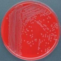 Kingdom: Bacteria Class: Alphaproteobacteria Order: Rhizobiales Bartonella bacilliformis B.