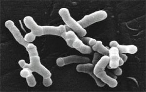 Actinobacteridae; Bifidobacteriales; Bifidobacteriaceae; Bifidobacterium; Bifidobacterium longum.