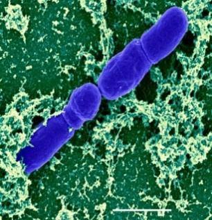 Kingdom: Bacteria Phylum: Actinobacteria Class: Actinobacteria Order: Bifidobacteriales Family: Bifidobacteriaceae Genus: Bifidobacterium 108.