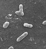30 110. Kingdom: Bacteria Class: Betaproteobacteria Order: Burkholderiales Family: Alcaligenaceae Genus: Bordetella 111.
