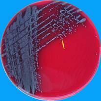 Kingdom: Bacteria Class: Betaproteobacteria Order: Burkholderiales Family: Alcaligenaceae Genus: Bordetella 113.