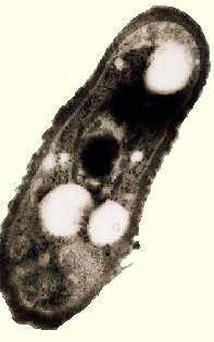 31 Order: Rhizobiales centripetally-developing infection threads. Family: Bradyrhizobiaceae Genus: Bradyrhizobium 116.