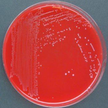 coli is very similar to its bacteria relative, Campylobacter jejuni (C. jejuni); both cause inflammation of the intestine and cause diarrhea in infected animals and humans.
