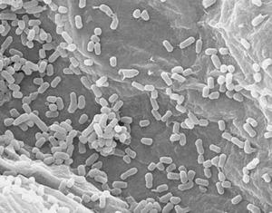 Attacks sugars fermentatively and gas is produced. Motile. Mesophile. Class: Gammaproteobacteria Order: Enterobacteriales Family: Enterobacteriaceae Genus: Citrobacter 146.