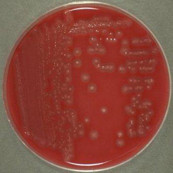 Kingdom: Bacteria Phylum: Firmicutes Class: Clostridia Order: Clostridiales Family: Clostridiaceae Genus: Clostridium 155.