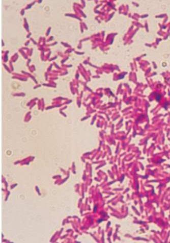 Kingdom: Bacteria Phylum: Actinobacteria Corynebacterium fujiokense Production of single cell protein Class: Actinobacteria Order: Actinomycetales Family: Corynebacteriaceae Genus: Corynebacterium