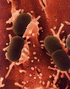 Kingdom: Bacteria Class: Gammaproteobacteria Order: Enterobacteriales Family: Enterobacteriaceae Genus: Escherichia 212.