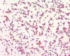 Francisella tularensis is a rod-shaped Gram-negative bacterium and is the causative agent of tularemia. Tularemia can affect both humans and animals.