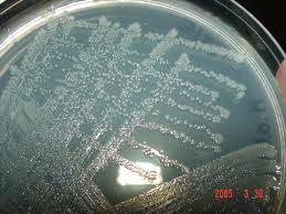 genus of the Enterobacteriaceae family whose only species is the Gram-negative, facultatively anaerobic, rod-shaped bacterium Hafnia alve. Family: Enterobacteriaceae Genus: Hafnia 242.