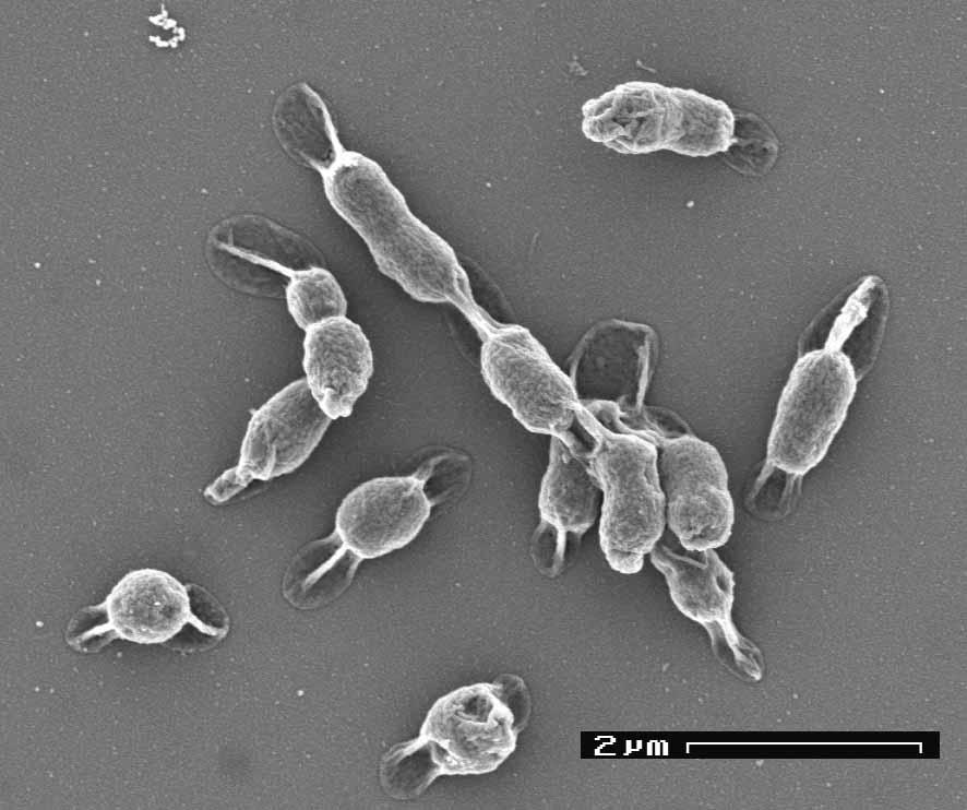 65 253. Kingdom: Bacteria Phylum: Actinobacteria Class: Actinobacteria Order: Actinomycetales Family: Micrococcaceae Genus: Kocuria 254.