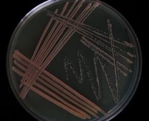 grampositive bacterium. It belongs to the family Micrococcaceae in the suborder Micrococcineae, a divergent bacterial group for which only limited amount of genomic information is currently available.