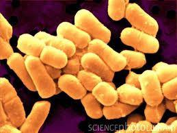 Lactobacillus fermentum is a Gram-positive species of bacterium in the genus Lactobacillus. It is associated with active dental caries lesions.